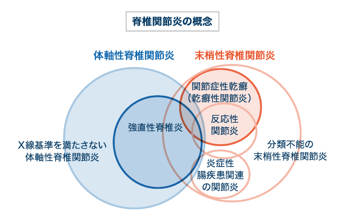股関節痛の診断